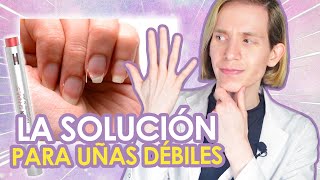 UÑAS DÉBILES Causas y soluciones reales  COMO SOLUCIONARLAS  Simon Scarano Dermatólogo [upl. by Ttirb]