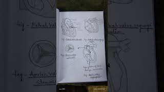 Assignment on valvular heart disease MSNIIgnm2ndyear bscnursing assignment notes study [upl. by Lirrad]