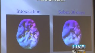 Addiction services doctor talks about substance abuse [upl. by Tice]