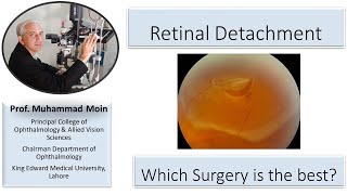 Retinal Detachment How to choose which surgery is the best [upl. by Essej]