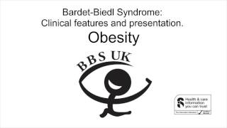 BardetBiedl Syndrome Obesity [upl. by Saberio]