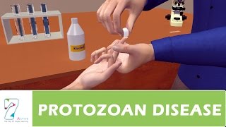 PROTOZOAN DISEASE PART 03 [upl. by Eiloj]