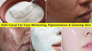 1 Time Skin Whitening Dahi Facial👆that removes Pigmentation amp Dark Spots Brightens Dull Dark Skin [upl. by Mafalda613]