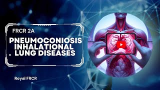 8  Chest Imaging for FRCR [upl. by Enaffit]