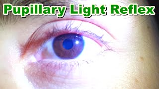 Pupillary Light Reflex  Contraction of Pupil MiosisMyosis  Function  Brain Stem [upl. by Bowra]