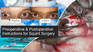 Preoperative amp Postoperative Instructions for Squint Surgery  Squint Surgery  Vision Eye Centre [upl. by Adnohsar189]