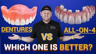 Dentures vs Snap in Dentures vs ALL on 4 ®️ Bridge [upl. by Sheela]