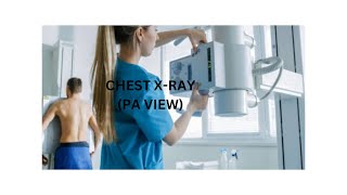 Chest xray pt 1 PA view [upl. by Oir]