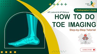 Essential Radiographic Techniques for Imaging Toes AP AP Oblique and Lateral Views [upl. by Aura316]