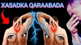 Xasadka Qaraabada Subxanallah  Fiiri Calamadihiisa amp Dawadiisa ShBacadle [upl. by Hadria121]