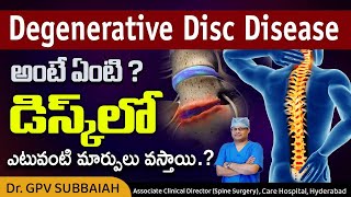 What is degenerative disc disease DDD   What happens in the disc in DDD  Dr GPV Subbaiah [upl. by Doig]