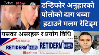 Retidrem 025tretinoin in Nepali।डन्डिफोरको दाग अनुहारको कालो चायाॅं पोतो हटाउने मलमacne [upl. by Creight]