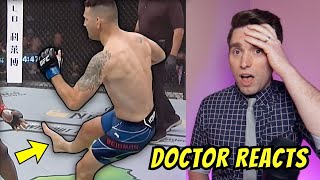 Doctor Reacts to Chris Weidman Shattered BROKEN Leg at UFC 261 [upl. by Ibloc81]