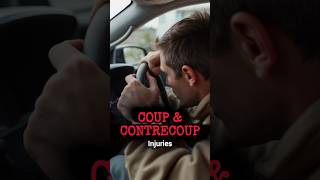 Coup and Contrecoup Head Injury shorts youtubeshorts [upl. by Stormy885]