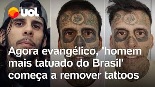 Homem mais tatuado do Brasil vira evangélico e começa a remover tatuagens vídeos mostram processo [upl. by Lunneta]