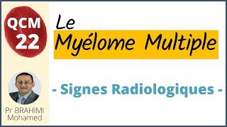 Myélome Multiple Signes Radiologiques  Hématologie QCM 22 [upl. by Ennyleuqcaj]