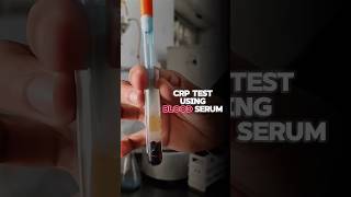 CRP test  creaction protein test shorts shortsfeed shortsvideo [upl. by Sergias]