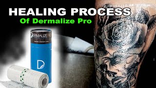 Healling Process of Dermalize Pro [upl. by Vories]