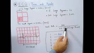 ECG Basics  Times and Speeds  Large and Small SquaresBoxes  Calculation of Heart Rate [upl. by Hiller]