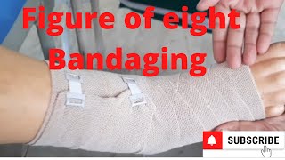 Figure of Eight Bandaging by PC nursing procedure [upl. by Hauge]