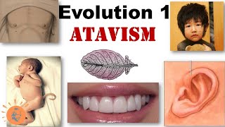 Atavism  Definition Causes  Examples  UrduHindi  Tanzeel ur Rehman [upl. by Neelhtak]