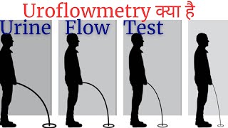 Uroflowmetry test in Hindi  urine flow test explained  Uroflowmetry test kaise hota hai [upl. by Lebama400]