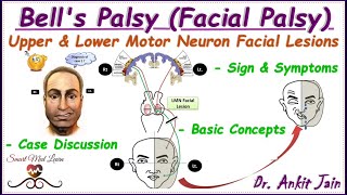 Bells palsy Upper and Lower motor neuron facial palsy Central facial palsyAnatomy Simplified [upl. by Ruelle]