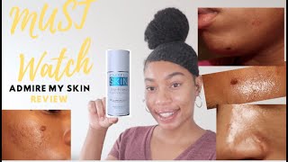 MUST WATCH  II Admire My Skin Review II HOW I DAMAGED MY SKIN LEARN FROM MY MISTAKES  SKINCARE [upl. by Alegnad]