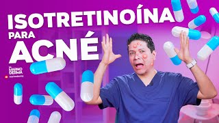 ISOTRETINOÍNA PARA ACNÉ  DERMATÓLOGO OPINA [upl. by Ahsatel]