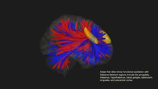 Functional connectivity of the Salience Network SN [upl. by Reyaht]