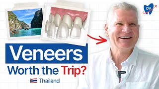 Porcelain Dental Veneers in Thailand Australian Patient Shares His Story [upl. by Tu]