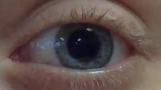 Pupil Dilation and Contraction [upl. by Ewold]