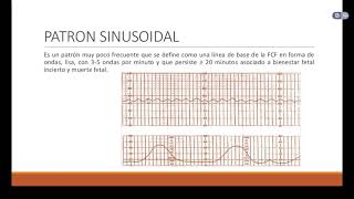 Desaceleraciones de Frecuencia cardiaca fetal [upl. by Daegal364]