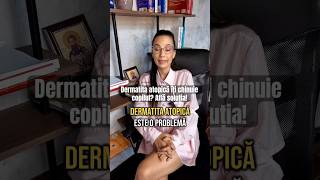 Dermatita atopică îți chinuie copilul Află soluția [upl. by Hgiellek]