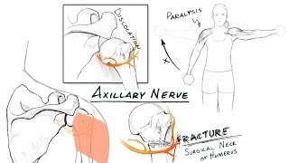 The Brachial Plexus II Animated Review HD [upl. by Yelsew]