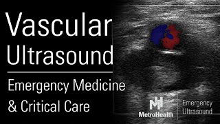 Vascular Ultrasound in Emergency Medicine amp Critical Care [upl. by Thad]