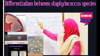 Differences between staphylococcus species [upl. by Axela]