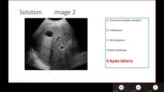 Radio  Limagerie du foie pancréas et voies biliaires [upl. by Odnamra]