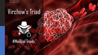 Virchows Triad of Thrombosis  Shorts MedicalTriads [upl. by Danica392]