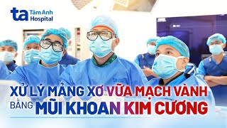 Xử lý mảng xơ vữa mạch vành bằng mũi khoan kim cương  BSCKI Nguyễn Đức Hưng  BVĐK Tâm Anh [upl. by Jaeger500]