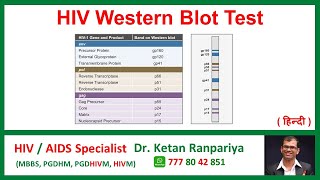 Understanding the HIV Western Blot Test Accuracy Results amp What it Means for You [upl. by Laemsi]