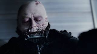 Why Darth Vader Didnt Survive In Return of The Jedi [upl. by Annasor]