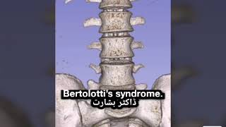 Bertolotti’s syndrome [upl. by Sinned]