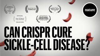 Can CRISPR cure Sicklecell Disease [upl. by Guidotti178]