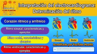 Electrocardiograma interpretación  Electrocardiograma  Determinación del ritmo  Ejemplos [upl. by Anaitak]