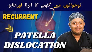 Recurrent Patella Dislocation drkhalidrehman mostsearchedvideo bestorthopedicsurgeon [upl. by Sadinoel]