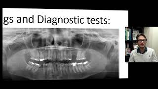 Cracked tooth mimicking neuralgia [upl. by Ahseinet]