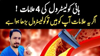 4 Warning Signs of High Cholesterol  Dr Irfan Azeem [upl. by Eanat]