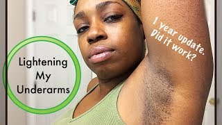 Lightening my underarms using lemon juice Did it work 1 year update [upl. by Enomys]