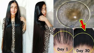 নতুন চুল গজাতে পেঁয়াজের রসের উপকারীতা  How To Use Onion Juice For Hair RegrowthExtreme Hair Growth [upl. by Amersham318]